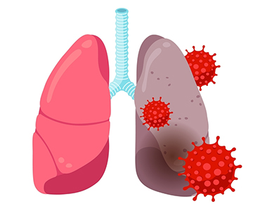 How to handle long Covid complications